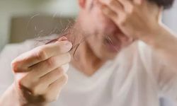 Saç dökülmesinin önüne nasıl geçilir?