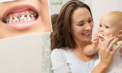 Bebeklerde sessiz tehlike: Biberon çürüğü! En sık ön dişlerde görülüyor