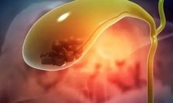 Uzmanı uyardı: İdrar rengi, o hastalığın habercisi olabilir