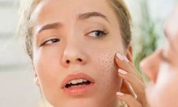 Soğuk hava en çok yüz, el ve dudağı kurutuyor!