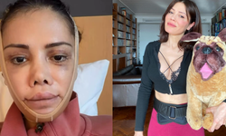 Didem Ceran’dan şaşırtan karar: Kore’de yüz nakli geçirdi