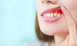 ‘Diş eti hastalıkları kalp ve damar sağlığını olumsuz etkiliyor’