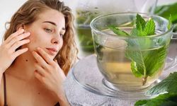Kıvırcık nane çayı hormonal akneye iyi gelir mi?