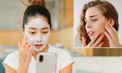 Sosyal medyadaki cilt bakım trendlerine dikkat! Sivilceleri artırıyor