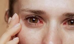 Bahar aylarında göz şikayetlerini hafife almayın! Kalıcı hasara neden oluyor