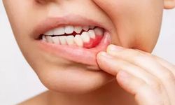 Fırçalamayı ihmal etmek hafızayı silebilir! Diş eti sağlığı hakkında ezber bozan gerçek