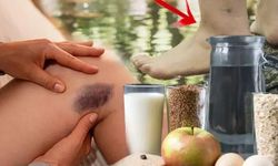 'Gitmeyen kilo' değil, doğrudan hastalık! Milyonlarca kadında var, aynı bölgede yoğunlaşıyor