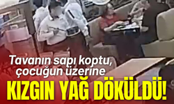 Tavanın sapı koptu, kızgın yağ çocuğun üzerine döküldü!