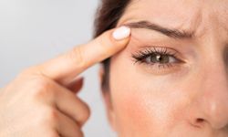 Botoks Sonrası Göz Kapağı Neden Düşebilir?
