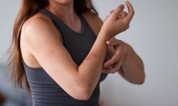 Alerji mi, histamin dengesizliği mi? Histamin dengesizliği nedir?