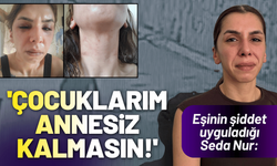 Eşinin şiddet uyguladığı Seda Nur: Çocuklarım annesiz kalmasın!