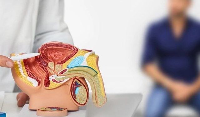 50 yaş üstü her erkek bu testi yaptırmalı