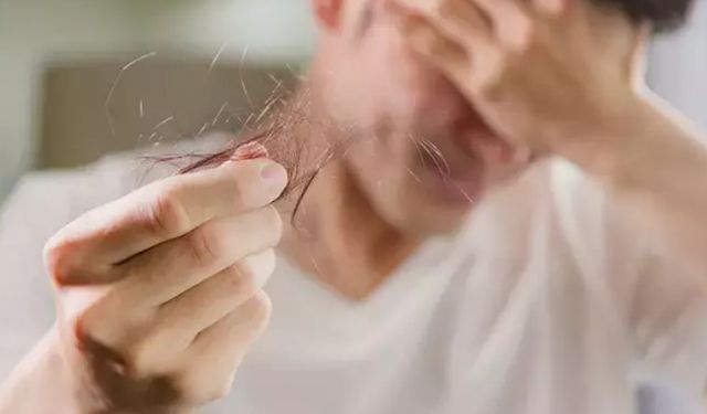 Saç dökülmesinin önüne nasıl geçilir?