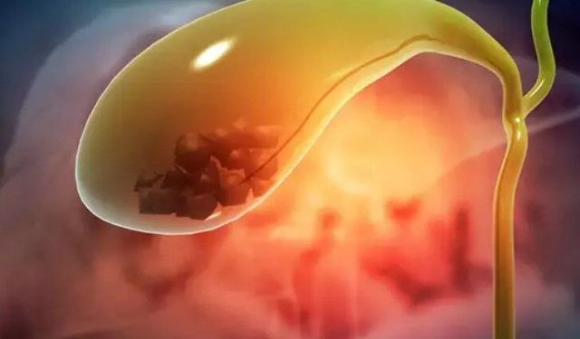 Uzmanı uyardı: İdrar rengi, o hastalığın habercisi olabilir