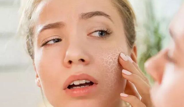 Soğuk hava en çok yüz, el ve dudağı kurutuyor!