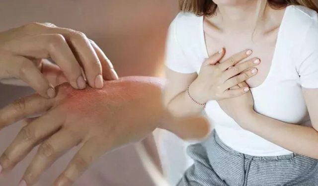 “Alerji” deyip geçmeyin! Sadece ciltte değil, kalpte de etkili olabiliyor