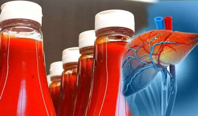 Lezzetine aldanan yandı! Karaciğeri parçalayan besin, iltihabı sessiz