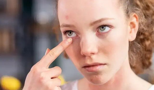 Mevsimsel değişim cildinizi tehdit etmesin! Uzmanlardan bahar uyarısı