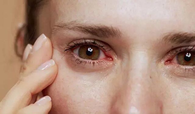 Bahar aylarında göz şikayetlerini hafife almayın! Kalıcı hasara neden oluyor