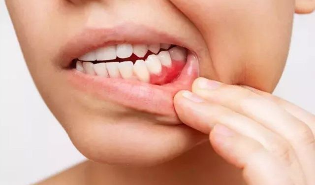 Fırçalamayı ihmal etmek hafızayı silebilir! Diş eti sağlığı hakkında ezber bozan gerçek