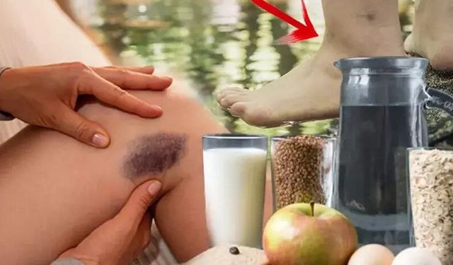 'Gitmeyen kilo' değil, doğrudan hastalık! Milyonlarca kadında var, aynı bölgede yoğunlaşıyor