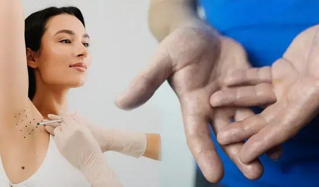 Özgüveni düşürüyor! Terlemenin çözümü botoks mu, cerrahi mi?