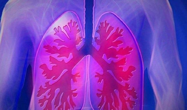 Akciğer vebası nedir ve ne kadar tehlikeli?