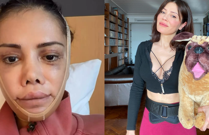 Didem Ceran’dan şaşırtan karar: Kore’de yüz nakli geçirdi