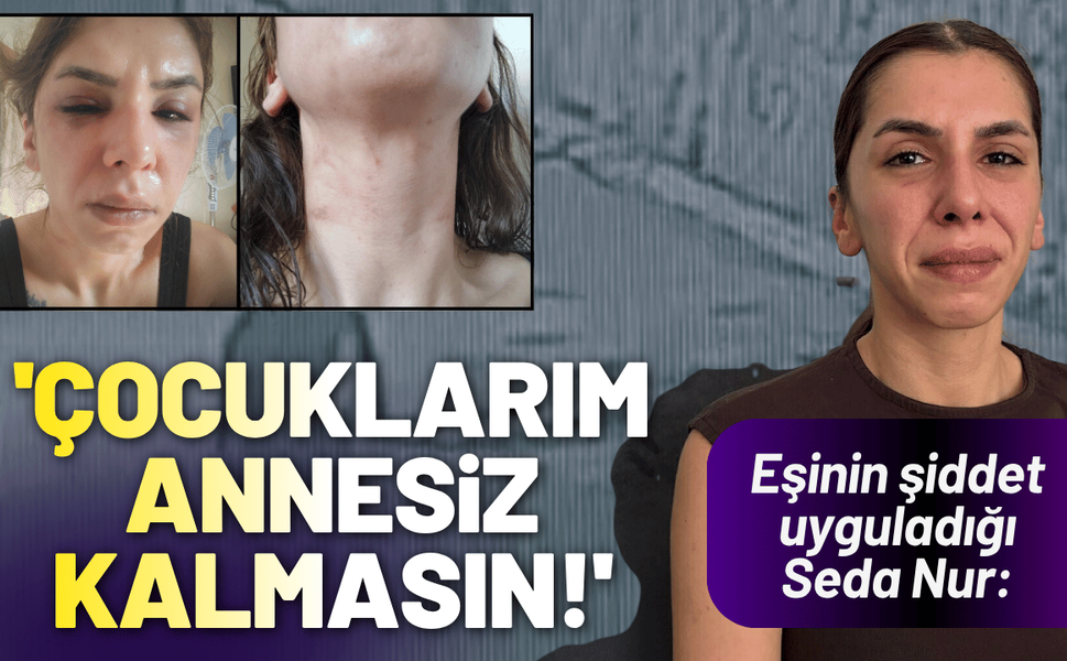 Eşinin şiddet uyguladığı Seda Nur: Çocuklarım annesiz kalmasın!